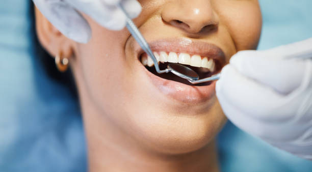 Best Emergency Treatment for Toothache in Lexington, TX